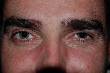 Oeil de braise